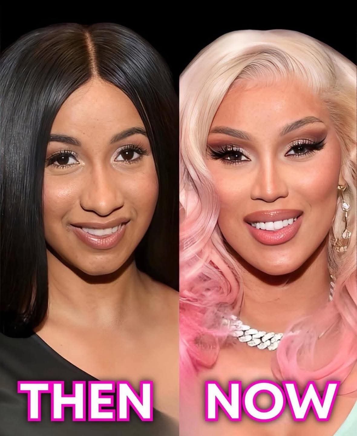Umuhanzi Cardi B mbere na nyuma yo gukoresha surgery.
