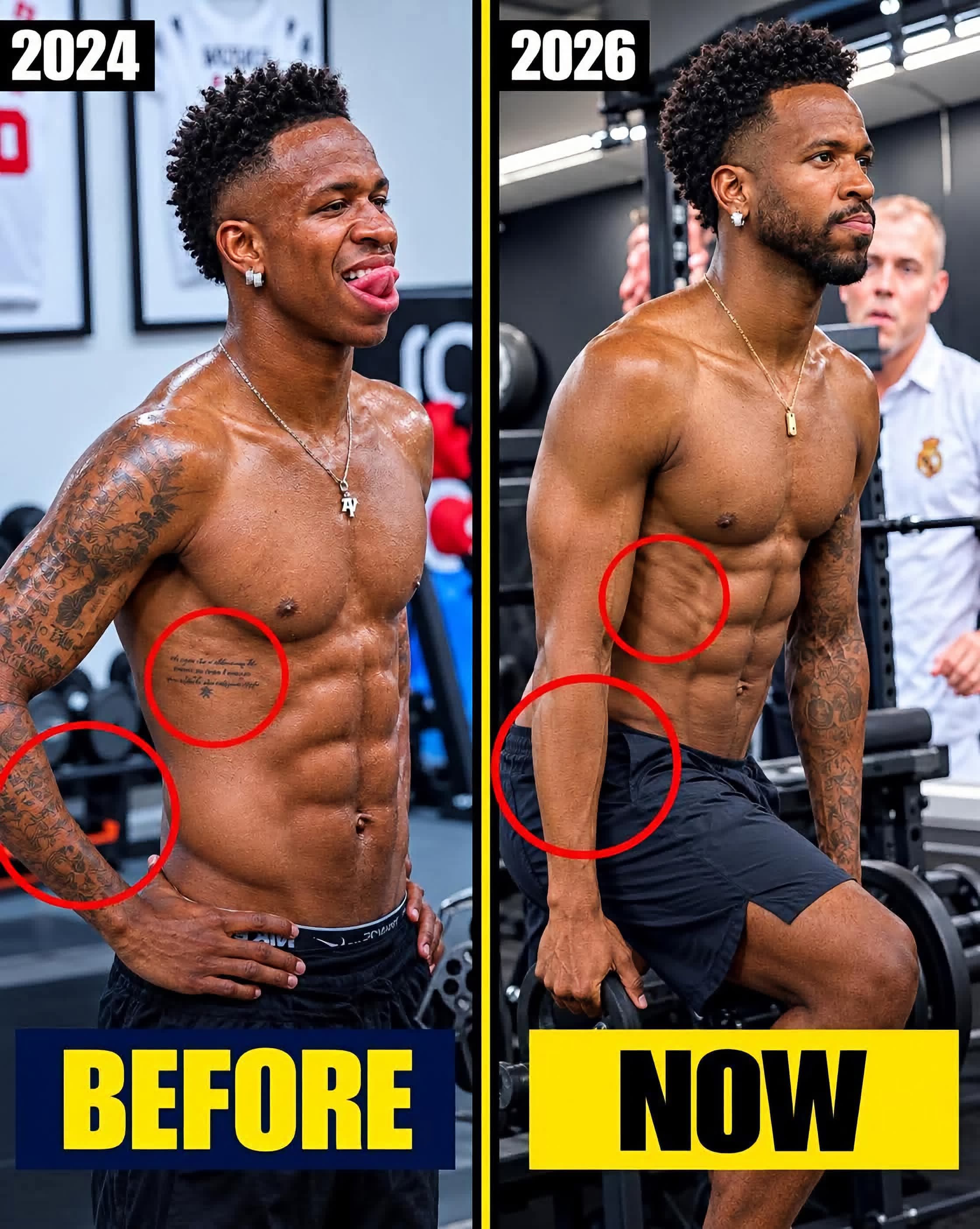 Vinicius Junior mbere na nyuma yo gukoresha surgery 